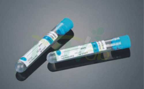 Non-vacuum Citrate Tube with Stopper